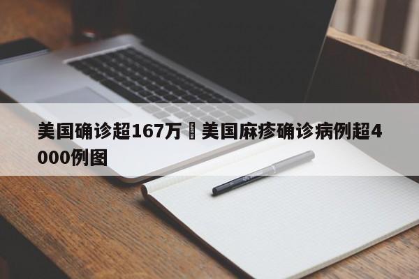 美国确诊超167万›美国麻疹确诊病例超4000例图